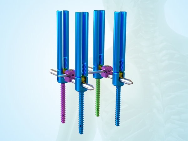 微創(chuàng)脊柱內(nèi)固定器Ⅰ型