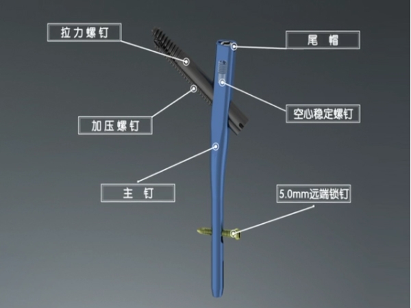 伽瑪IV型髓內(nèi)釘系統(tǒng)操作演示